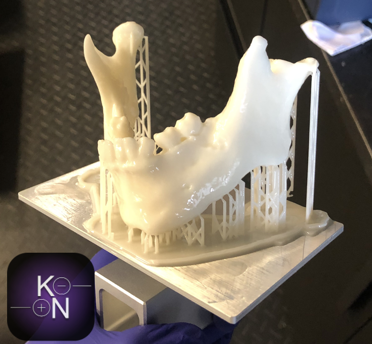 Wydrukowany model 3D w technologii DLP drukarka żywiczna